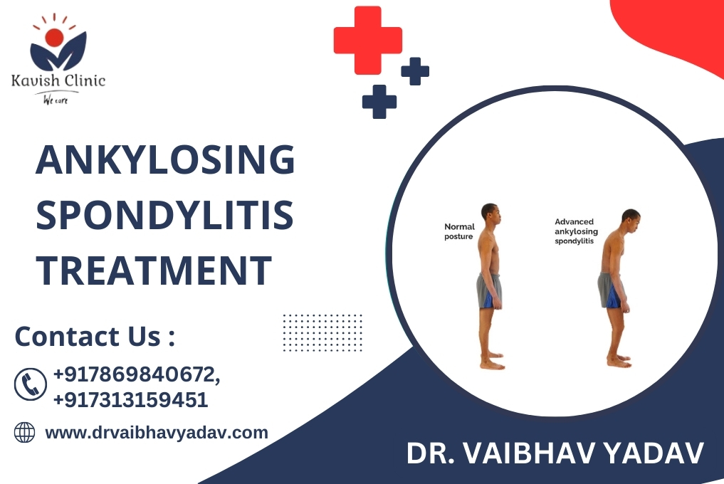 Best Ankylosing Spondylitis Treatment in Indore